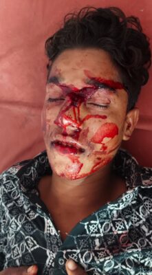 KAIMGANJ NEWS ЁЯЪи рддреЗрдЬ рд░рдлреНрддрд╛рд░ рдХрд╛ рддрд╛рдВрдбрд╡: рд░реБрджрд╛рдпрди рд░реЛрдб рдкрд░ рдЖрдордиреЗ-рд╕рд╛рдордиреЗ рднрд┐рдбрд╝реАрдВ рдмрд╛рдЗрдХреЗрдВ, рджреЛ рдЬрд┐рдВрджрдЧреА рдореМрдд рд╕реЗ рдЬрдВрдЧ рдореЗрдВ ЁЯЪи Picsart 26 04 18 06 07 26 086