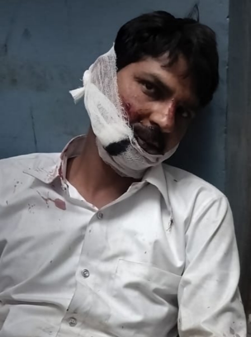 Farrukhabad news अलग-अलग मार्ग दुर्घटनाओं में दो की मौत, दो गंभीर घायल Picsart 26 04 20 19 48 36 993