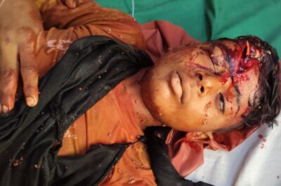 KAIMGANJ NEWS रफ्तार का कहर: तेज पिकअप ने मासूम छात्र को रौंदा, हालत नाजुक IMG 20260508 WA0312