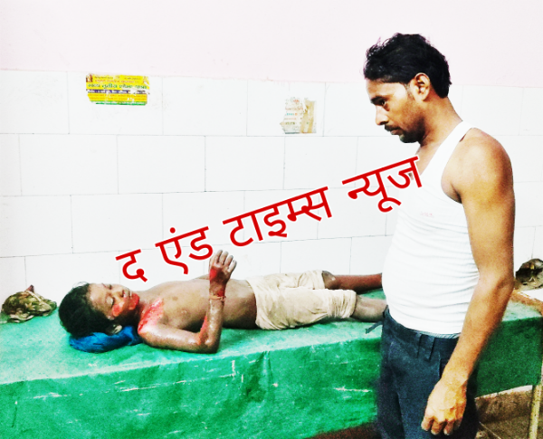 KAIMGANJ NEWS कंपिल में नगर पंचायत के कूड़ा ट्रैक्टर का खूनी खेल: 8 साल की मासूम को बेरहमी से रौंदा, हालत नाजुक, लोहिया रेफर Picsart 26 08 26 09 05 12 264