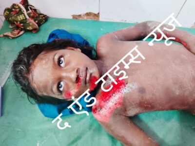 KAIMGANJ NEWS कंपिल में नगर पंचायत के कूड़ा ट्रैक्टर का खूनी खेल: 8 साल की मासूम को बेरहमी से रौंदा, हालत नाजुक, लोहिया रेफर Picsart 26 08 26 09 06 13 552