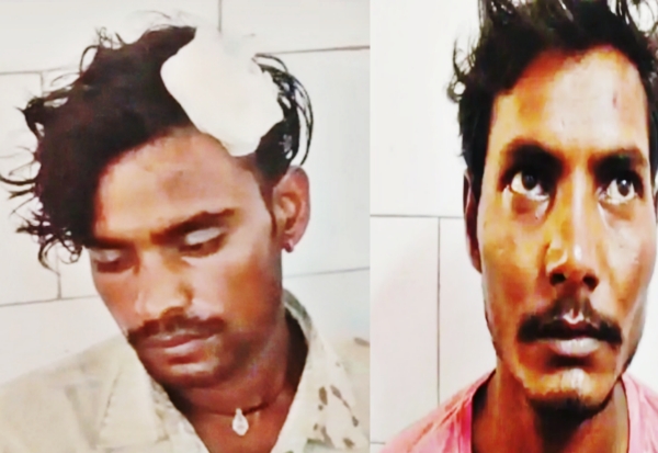 Farrukhabad news अंधविश्वास का खूनी खेल: चचेरे भाइयों ने लगाया ‘टोना-टोटका’ का आरोप, घर में घुसकर लाठी-सरिया से फोड़े सिर Picsart 26 09 05 15 12 00 773
