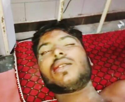 KAIMGANJ NEWS पुरानी रंजिश ने लिया हिंसक रूप, पांच भाइयों को घेरकर लाठी-सरिया से पीटा Picsart 26 09 18 06 18 19 244